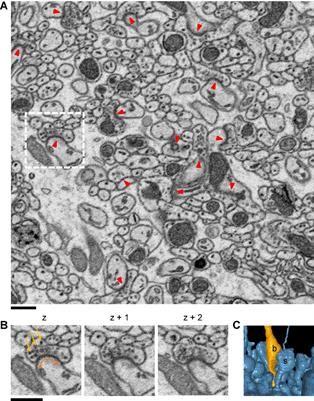 Automated Synapse Detection Method for Cerebellar Connectomics